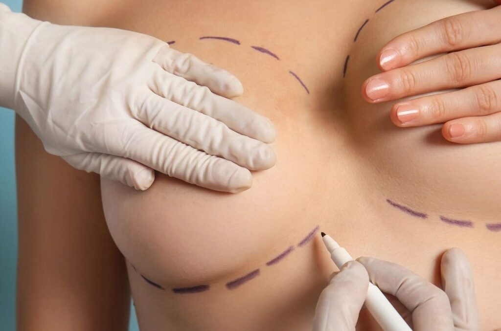 Breast Enlargement Surgery in Dubai Understanding the Role of Anesthesia