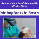 Restore-Your-Confidence-with-World-Class-Hair-Implants-in-Boston