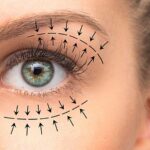 Common Myths About Blepharoplasty Debunked