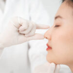 Rhinoplasty in Riyadh