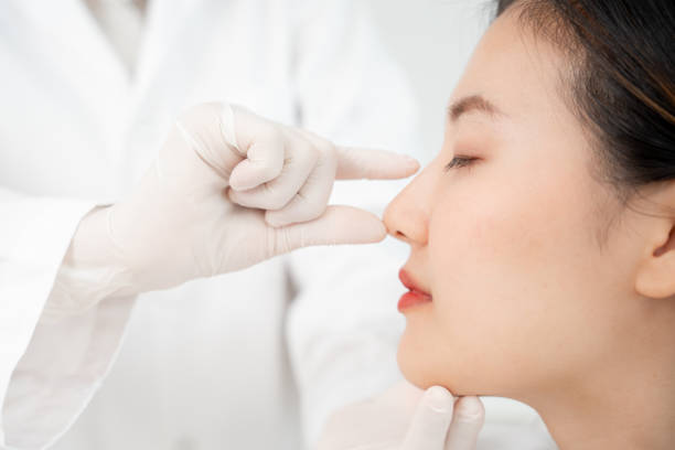 Rhinoplasty in Riyadh