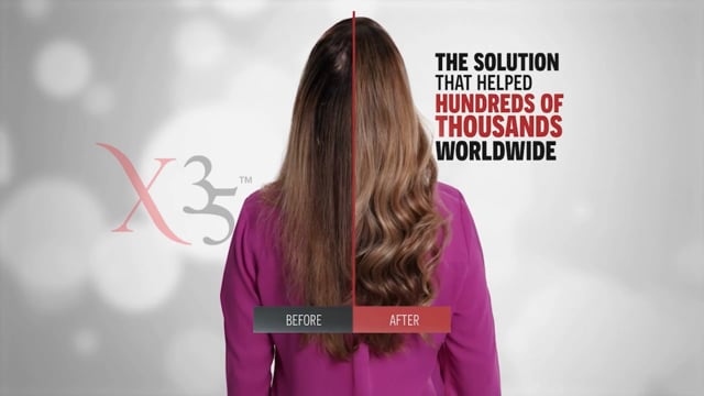 HAIR XCELLERATION PROGRAM