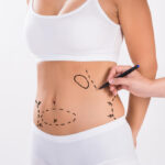 How Liposuction in Dubai Can Affect Your Psychological Well-being