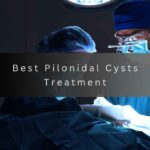 best pilonidal cysts treatment