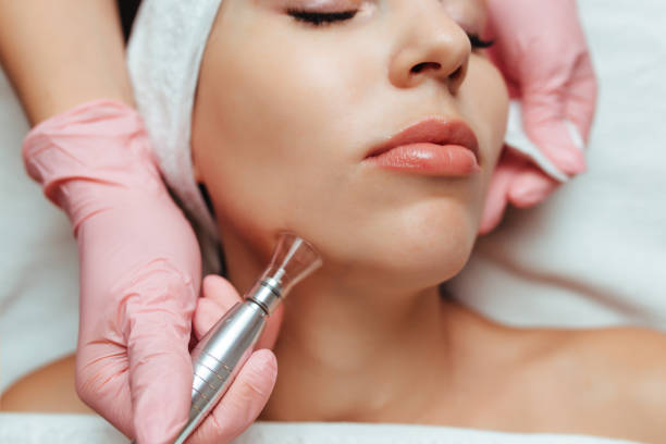 Top Skin Tag Removal & Laser Hair Removal Treatments