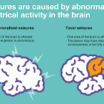 type of seizures