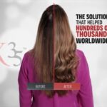 HAIR XCELLERATION PROGRAM