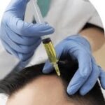 PRP Hair Injection in Dubai