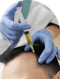 PRP Hair Injection in Dubai