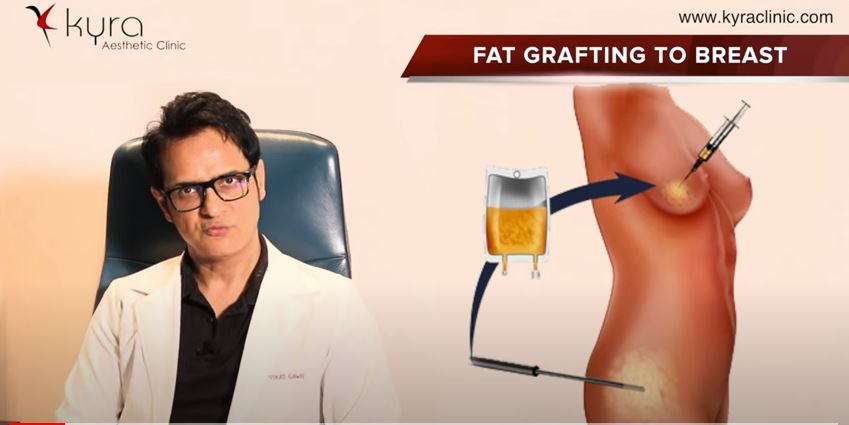 https://kyraclinic.com/fat-transfer-to-breast-cost