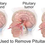 pituitary hormones