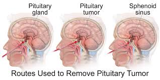 pituitary hormones