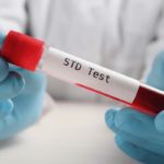 STD Blood Tests