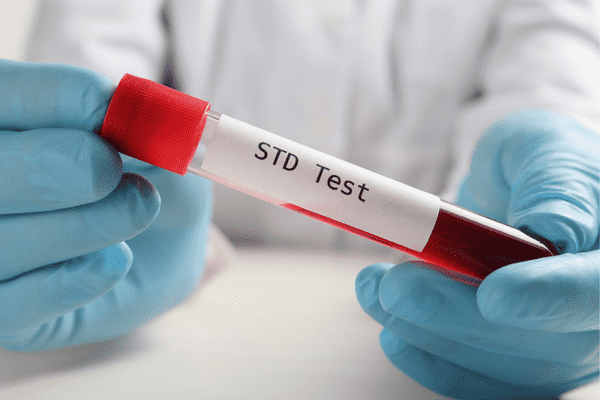 STD Blood Tests