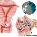 Europe Cervical Cancer Screening Market Size And Forecast Report 2024-2032