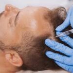 Plasma Injection for Hair in Dubai