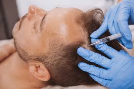 Plasma Injection for Hair in Dubai