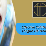 Tongue Tie Treatment