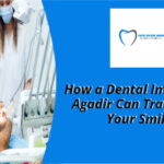 Dental Implant in Agadir