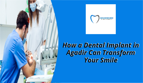 Dental Implant in Agadir