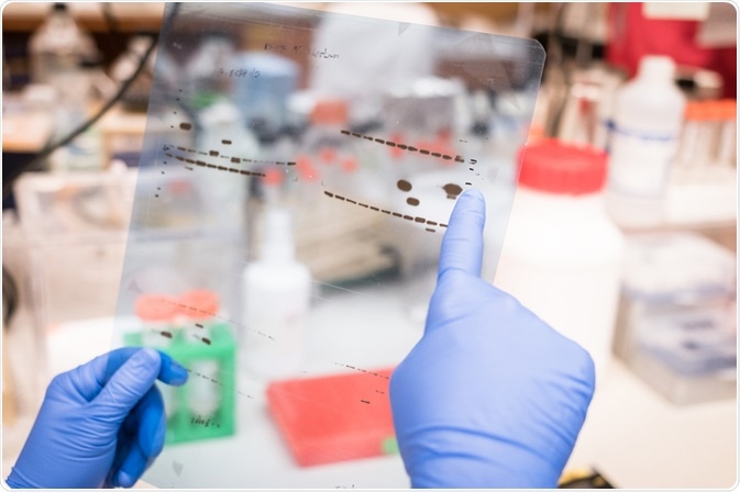 Western Blot Phosphorylated Proteins